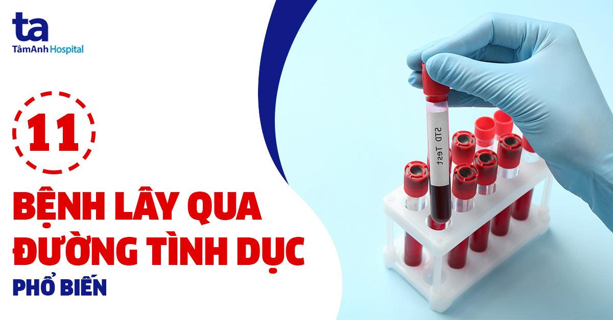 Bệnh lây qua đường tình dục là gì? 11 căn bệnh tình dục nguy hiểm