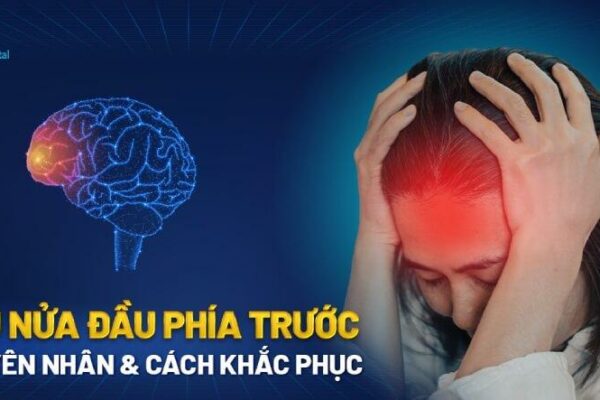 Đau nửa đầu phía trước là bệnh gì? Nguyên nhân và cách khắc phục