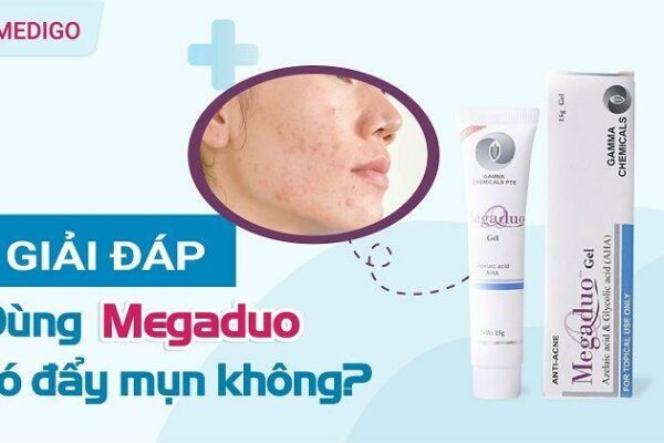 Giải đáp: Dùng Megaduo có đẩy mụn không?