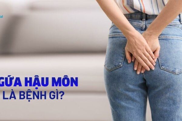 Ngứa hậu môn là bệnh gì? Nguyên nhân, triệu chứng và cách phòng