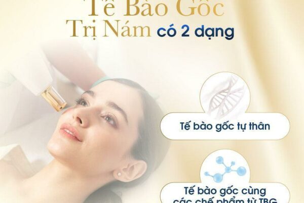 Tế bào gốc trị nám là gì? Các loại tế bào gốc tốt nhất [Cập nhật 2023]