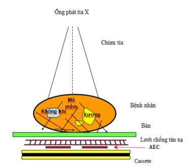 Bản chất tia X và cấu tạo - nguyên lý hoạt động của máy X-quang