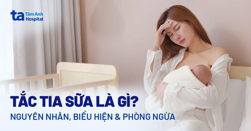 Tắc tia sữa sau sinh: Nguyên nhân, biểu hiện, chẩn đoán và phòng ngừa