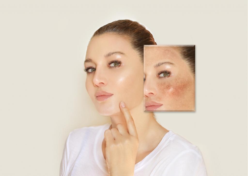 3 Giai đoạn khi dùng Retinol: từ bong tróc đến da đẹp mỹ mãn