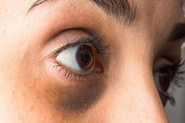 5 Cách che khuyết điểm quầng thâm mắt cho người mới trang điểm - Viện Thẩm Mỹ KangJin