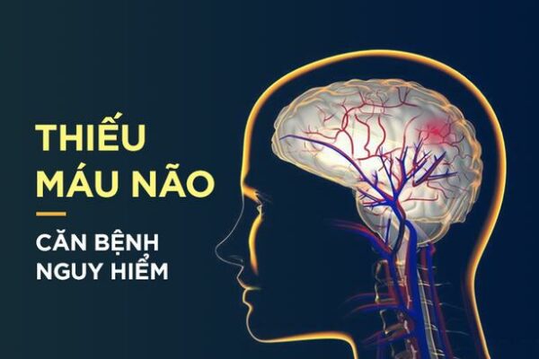 6 MẸO GIÚP LƯU THÔNG MÁU LÊN NÃO