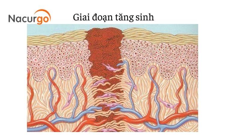 Chăm sóc vết thương lên da non cần lưu ý gì?