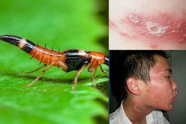 Bệnh viện quận 11 Bệnh viện quận 11