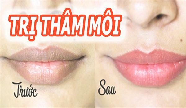 15 cách trị thâm môi tại nhà nhanh chóng chỉ trong 1 tuần