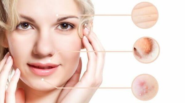 Collagen là gì? Tác dụng của Collagen cho làn da và sức khỏe