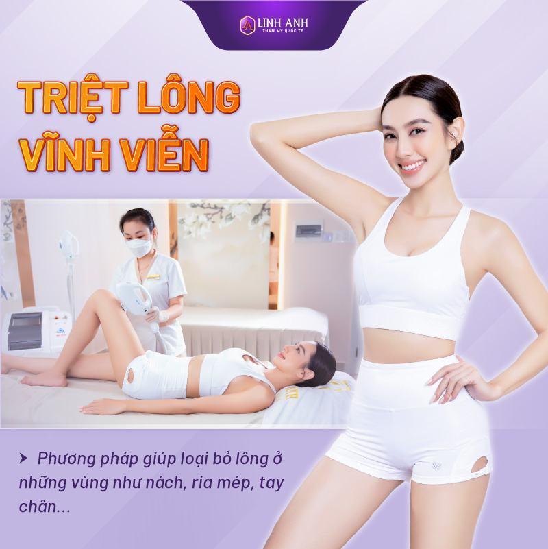 Triệt lông vĩnh viễn giá bao nhiêu? Bảng giá triệt lông mới nhất 2023