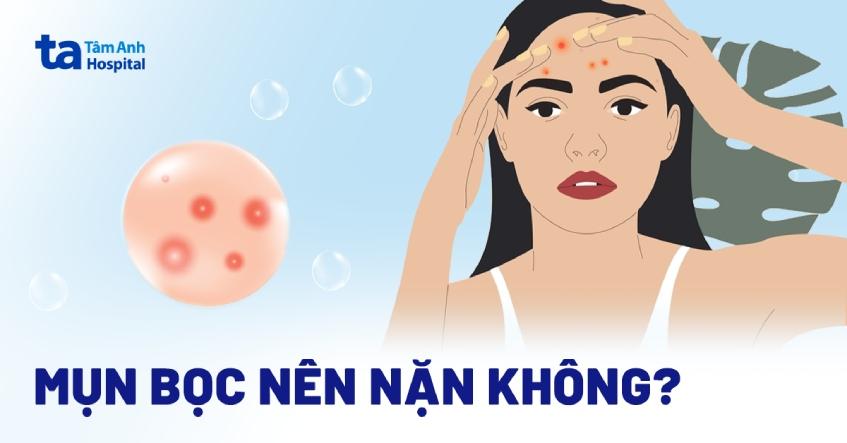 Mụn bọc có nên nặn không? Khi nào thì nặn được? Đặc điểm nhận dạng