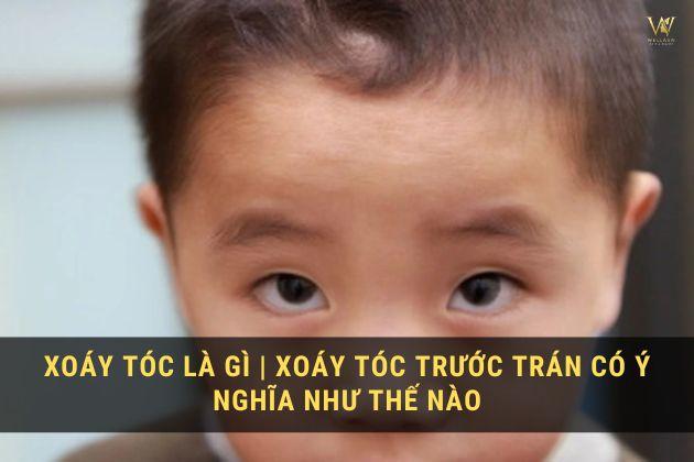 Xoáy tóc là gì | Xoáy tóc trước trán có ý nghĩa như thế nào