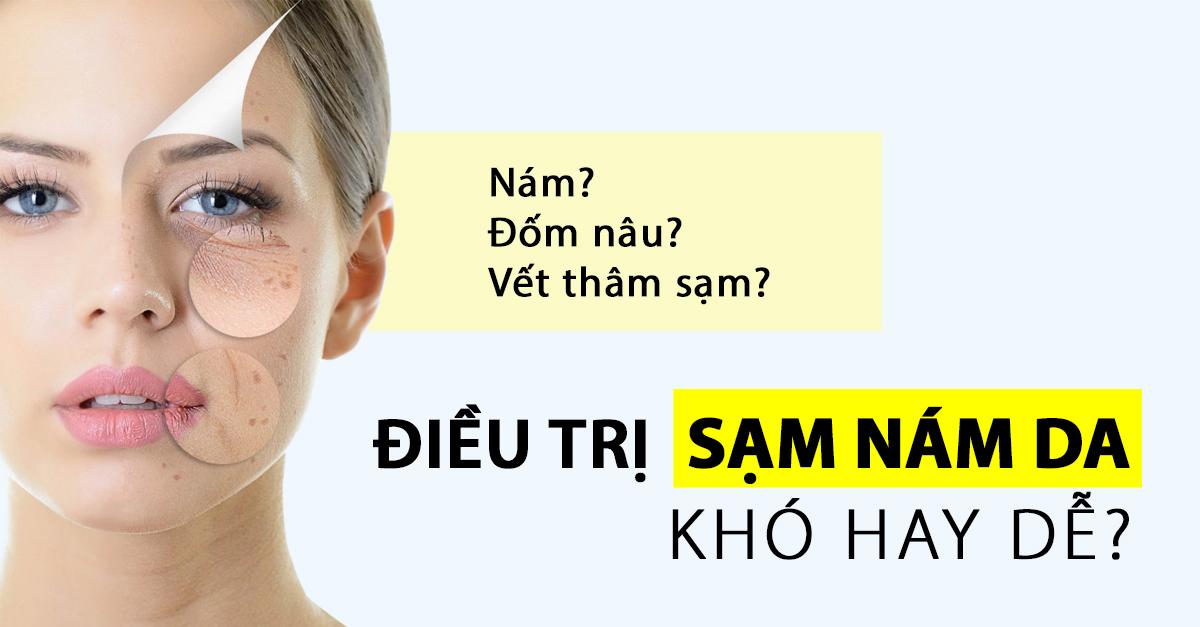 Trị sạm nám da và dưỡng trắng da an toàn