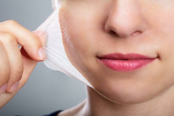 Quy trình chăm sóc da sau peel hiệu quả & sản phẩm nên dùng