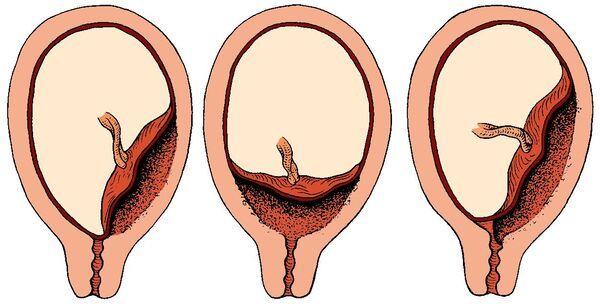 Placenta là gì? Tác dụng của Placenta đối với sức khỏe và sắc đẹp