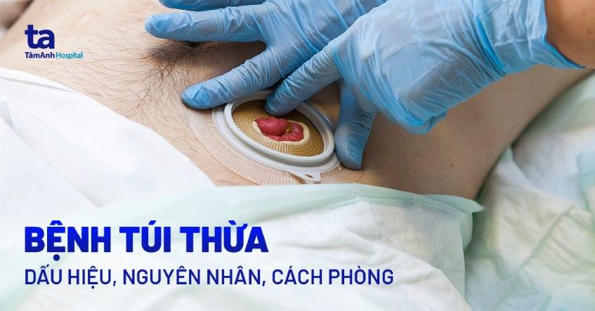 Bệnh túi thừa là gì? Dấu hiệu nhận biết, nguyên nhân và cách phòng