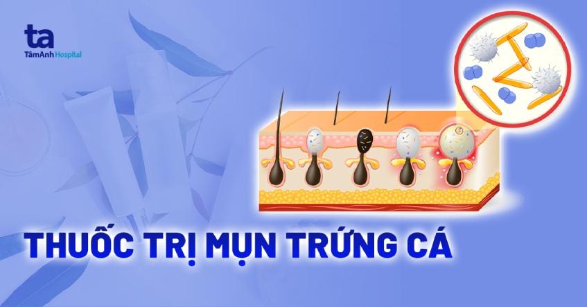 Top 12 thuốc trị mụn trứng cá dạng bôi và uống tốt nhất hiện nay