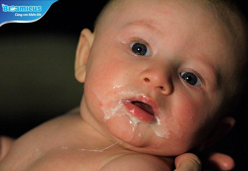 Tiết lộ nguyên nhân trẻ sơ sinh trớ nhiều cặn sữa và cách xử lý