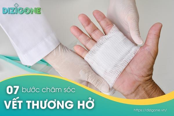 7 bước chăm sóc vết thương hở hiệu quả tại nhà