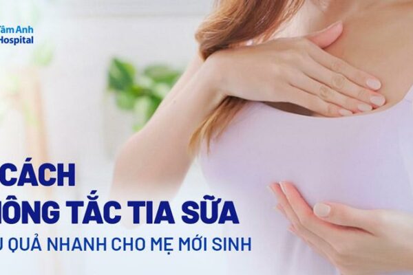 9 cách thông tắc tia sữa cho mẹ mới sinh nhanh và hiệu quả nhất