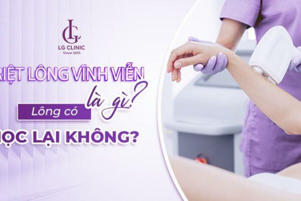 Bảng giá triệt lông vĩnh viễn mới nhất 2024