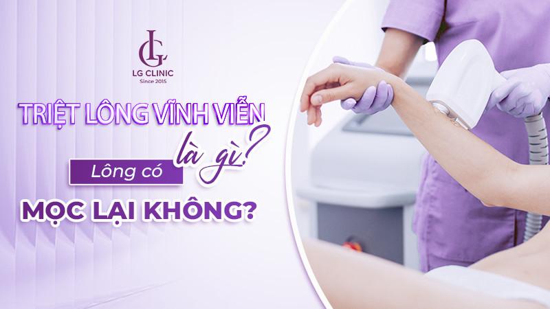 Bảng giá triệt lông vĩnh viễn mới nhất 2024