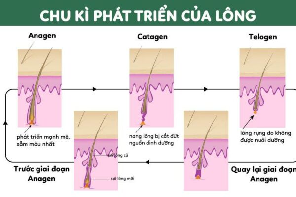 Cách Triệt Lông Chân Vĩnh Viễn Không Gây Đau Đớn