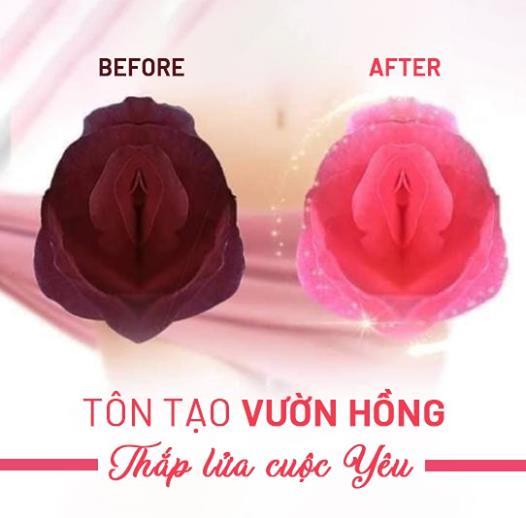 Chi Phí Làm Hồng Vùng Kín Là Bao Nhiêu Tiền?