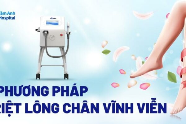 Triệt lông chân vĩnh viễn là gì? 4 cách được ưa chuộng hiện nay