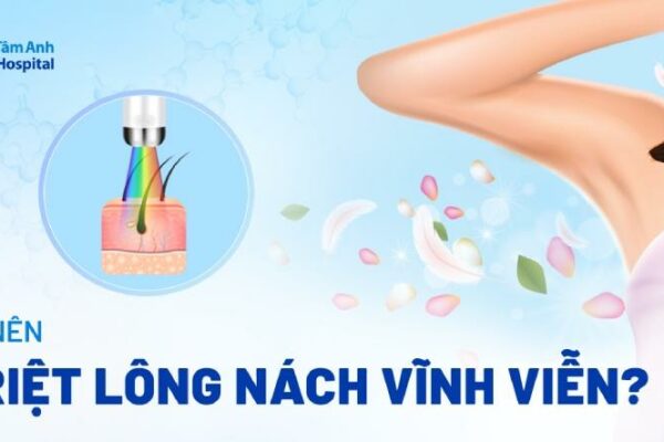 Triệt lông nách vĩnh viễn là gì? Có nên không? Ưu nhược điểm