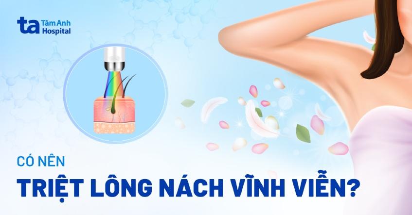 Triệt lông nách vĩnh viễn là gì? Có nên không? Ưu nhược điểm