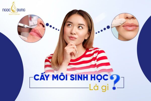 Cấy môi sinh học là gì? Ưu – nhược điểm và lưu ý khi cấy môi