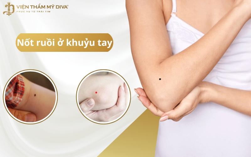 Giải Mã Bí Ẩn Nốt Ruồi Ở Khuỷu Tay: Tướng Số & Sức Khỏe