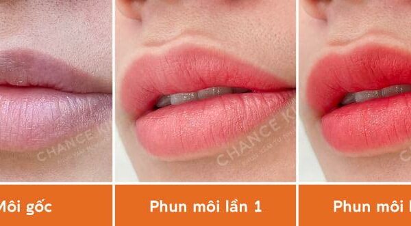 6 điều PHẢI BIẾT khi phun môi 2 lần để tránh tiền mất tật mang