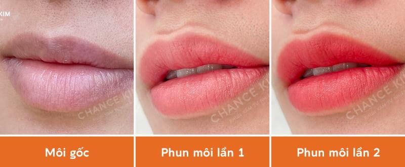 6 điều PHẢI BIẾT khi phun môi 2 lần để tránh tiền mất tật mang