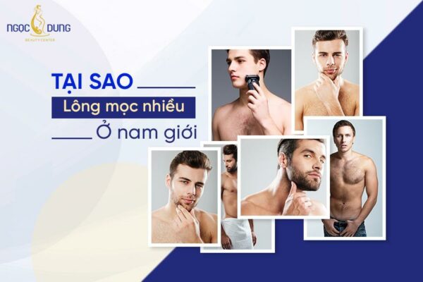 Tại sao lông mọc nhiều ở nam giới? Cách xử lý rậm lông nam