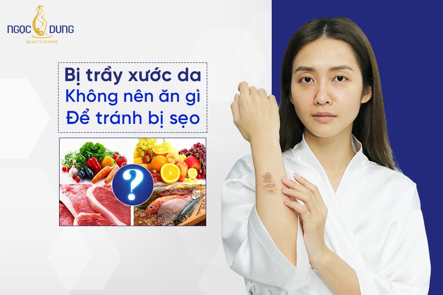 Bị trầy xước da không nên ăn gì để tránh bị sẹo, nhanh lành