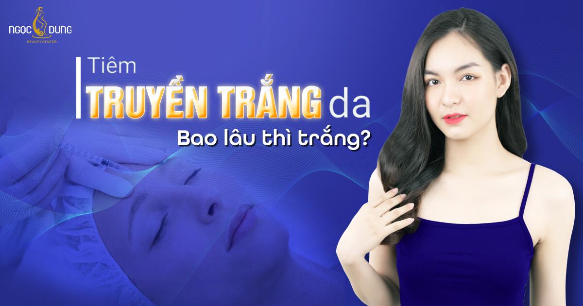 Truyền trắng là gì? Tiêm truyền trắng da bao lâu thì trắng?